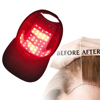 Saç Büyüme Lazer kask lambası Cips Anti Saç Dökülmesi Saç Büyüme Kap Saç dökülmesi tedavisi Cihazı Saç Çıkma Tedavisi Makinesi Şapka